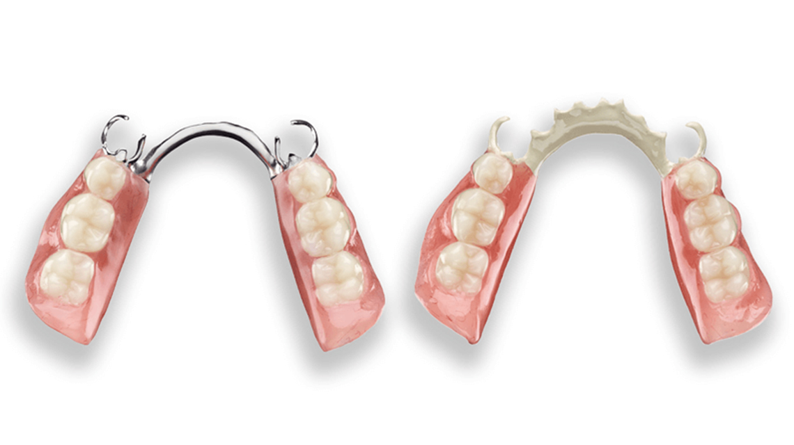 Dentalia smiles